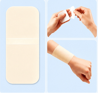 Hydrocolloid Dressing